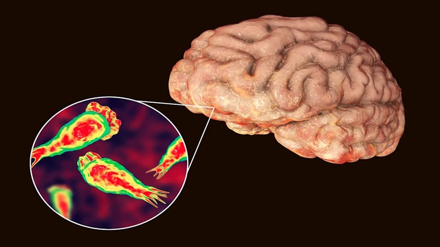Rất có thể bạn đã bị nhiễm một loại virus ăn não mà bạn chưa từng nghe đến - Ảnh 3.